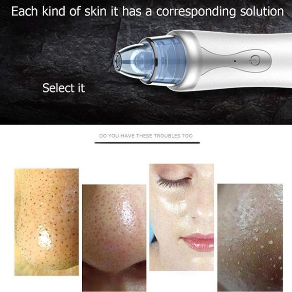 blackhead remover face clean vacuum pore cleaner face acne pore blackhead suction facial diamond tool
blackhead remover face clean vacuum pore cleaner face acne pore blackhead suction facial diamond tool