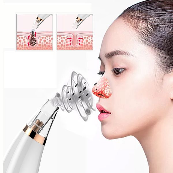 electric acne exfoliating blackhead remover face deep pore cleaner acne pimple removal vacuum suction facial spa diamond beauty
electric acne exfoliating blackhead remover face deep pore cleaner acne pimple removal vacuum suction facial spa diamond beauty