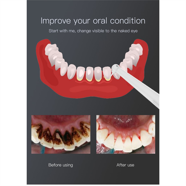 teeth whitening multi-functional teeth cleaning device oral clean sonic dental scaler teeth whitening tartar plaque stains remover
teeth whitening multi-functional teeth cleaning device oral clean sonic dental scaler teeth whitening tartar plaque stains remover