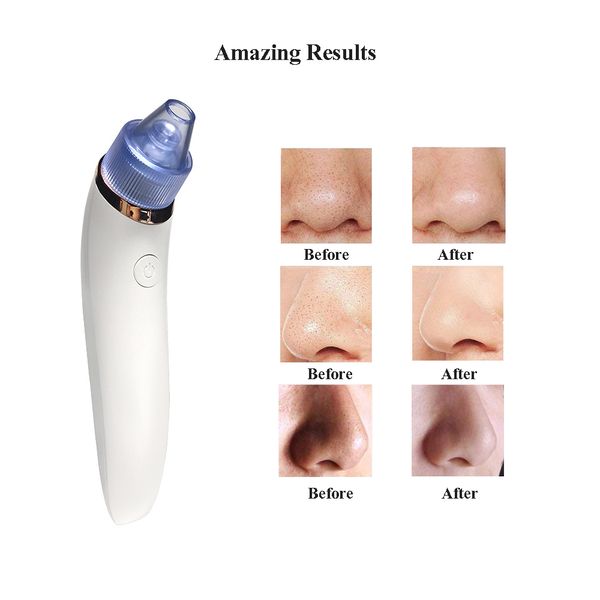 electric blackhead instrument cleansing instrument to blackhead pore cleaner blackhead artifact skin care tool
electric blackhead instrument cleansing instrument to blackhead pore cleaner blackhead artifact skin care tool