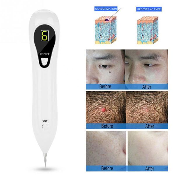 lcd pro mole freckle removal pen three levels adjustable spot tattoo remover facial freckle tag wart removal skin care tool
lcd pro mole freckle removal pen three levels adjustable spot tattoo remover facial freckle tag wart removal skin care tool