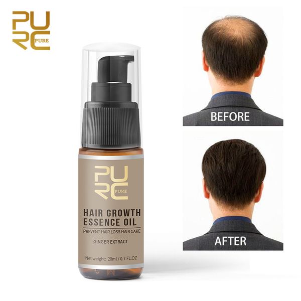 fast hair growth essence oil hair loss treatment help scalp health care cure hair liquid nutrient solution women men tslm1
fast hair growth essence oil hair loss treatment help scalp health care cure hair liquid nutrient solution women men tslm1