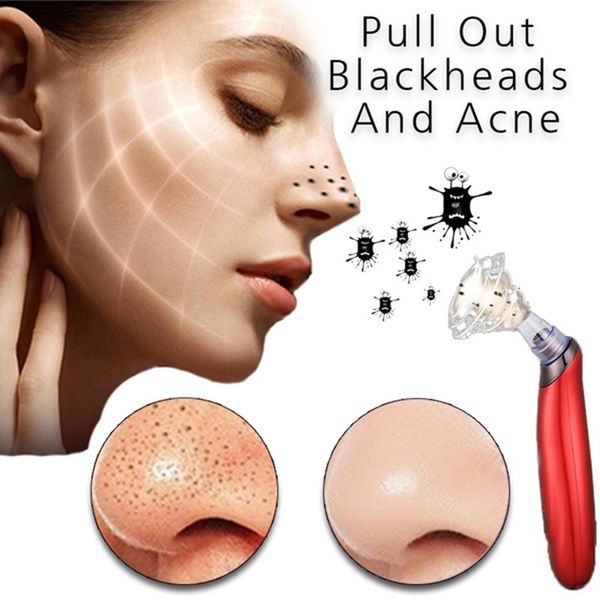 vacuum blackhead remover facial machine suction blackheads removal face skin care tools deep cleansing pores and blackheads
vacuum blackhead remover facial machine suction blackheads removal face skin care tools deep cleansing pores and blackheads