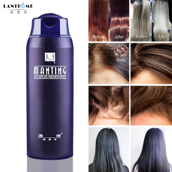 manting professional shampoo divide mite anti-itching anti dandruff suitable no silicone oil oil control for all hair types
manting professional shampoo divide mite anti-itching anti dandruff suitable no silicone oil oil control for all hair types