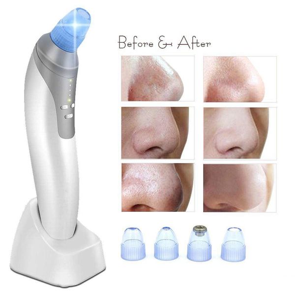 4 beauty heads vacuum blackhead remover tool electronic facial cleaner acne removal instrument utilizes pore vacuum extractor
4 beauty heads vacuum blackhead remover tool electronic facial cleaner acne removal instrument utilizes pore vacuum extractor