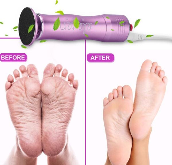 electric foot pedicure machine usb charging feet care tools callus remover foot file for heel foot dead skin
electric foot pedicure machine usb charging feet care tools callus remover foot file for heel foot dead skin