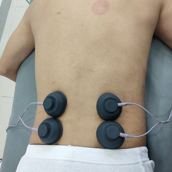 tech veterinary instrument horses equine shock wave therapy equipment for horse pain relief with 5pcs transmitter
tech veterinary instrument horses equine shock wave therapy equipment for horse pain relief with 5pcs transmitter