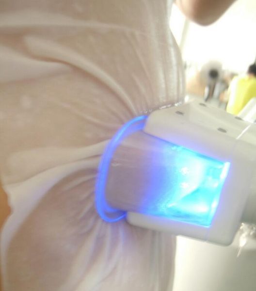 antie membrane cryo treatment antie membrane fat ing antie membrane anti e film for fat e
antie membrane cryo treatment antie membrane fat ing antie membrane anti e film for fat e