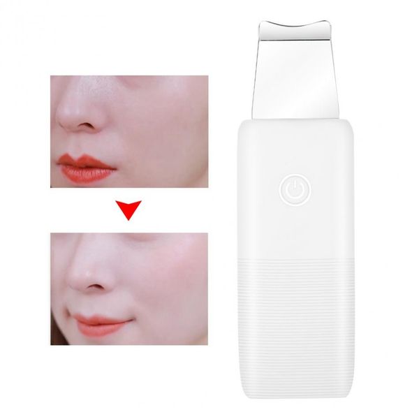new ultrasonic skin scrubber face skin deep cleansing spatula blackhead acne removal
new ultrasonic skin scrubber face skin deep cleansing spatula blackhead acne removal