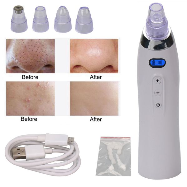 face pore cleaner blackhead remover vacuum comedo suction diamond dermabrasion facial cleaning beauty machine
face pore cleaner blackhead remover vacuum comedo suction diamond dermabrasion facial cleaning beauty machine