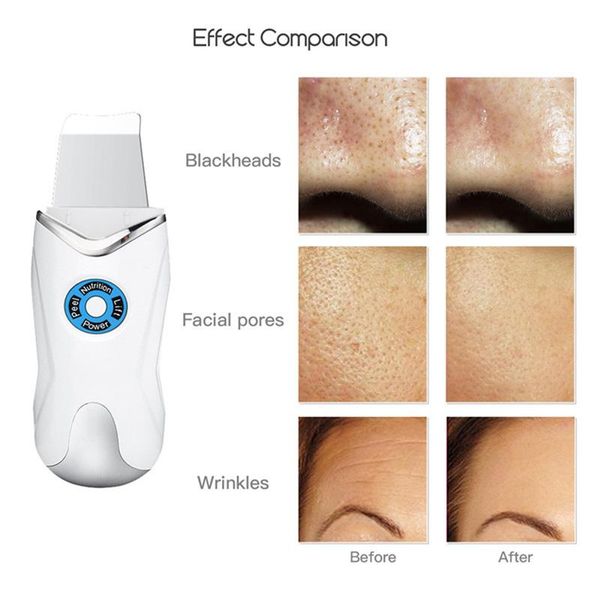 usb ultrasonic skin scrubber blue light pn rejuvenation facial cleaning machine ems face lifting pore cleaner massager p40
usb ultrasonic skin scrubber blue light pn rejuvenation facial cleaning machine ems face lifting pore cleaner massager p40