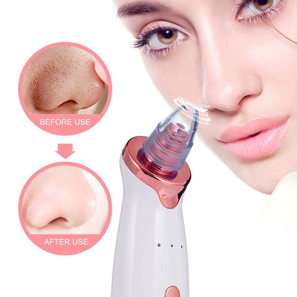 blackhead skin care deep pore face acne grain vacuum suction vacuum blackhead removal facial cleaning beauty tool rra2338
blackhead skin care deep pore face acne grain vacuum suction vacuum blackhead removal facial cleaning beauty tool rra2338