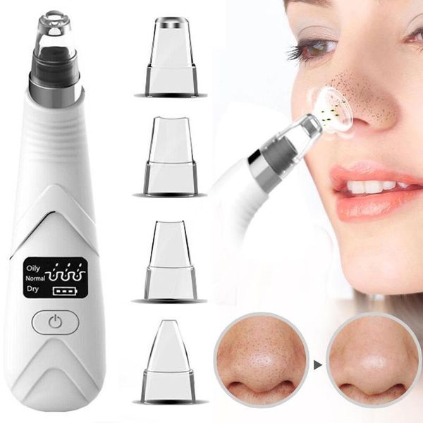 new usb blackhead remover electric facial pore cleaner blackhead vacuum face acne black dot pimple remover skin care beauty tool
new usb blackhead remover electric facial pore cleaner blackhead vacuum face acne black dot pimple remover skin care beauty tool