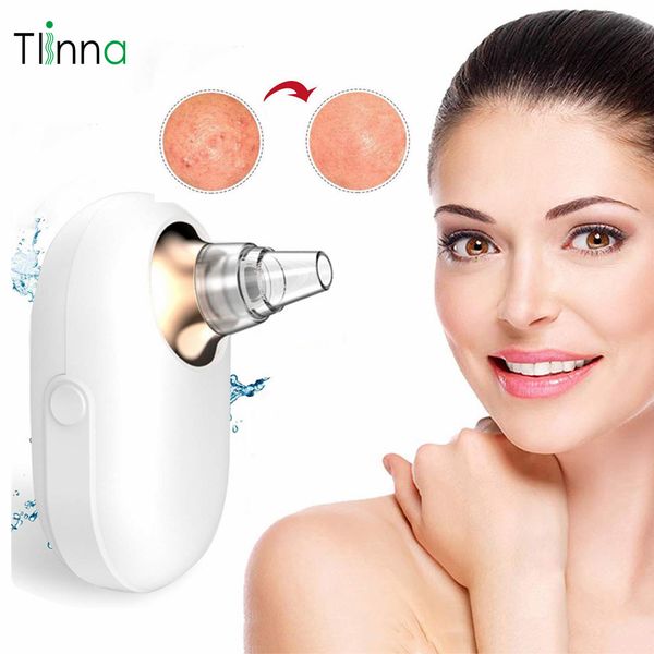 woodpecker electric blackhead cleansing instrument vacuum acne pore cleaner remover beauty skin facial care
woodpecker electric blackhead cleansing instrument vacuum acne pore cleaner remover beauty skin facial care