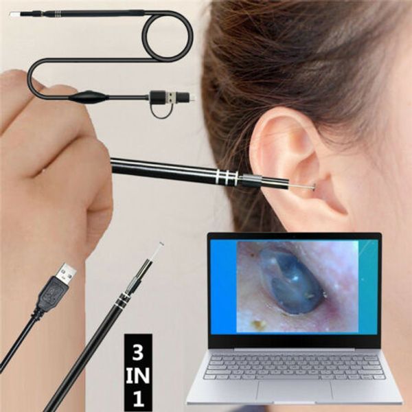 3in1 ear очистки эндоскопов usb 5.5mm визуальная earpick hd камеры ложка отоскоп
3in1 ear очистки эндоскопов usb 5.5mm визуальная earpick hd камеры ложка отоскоп