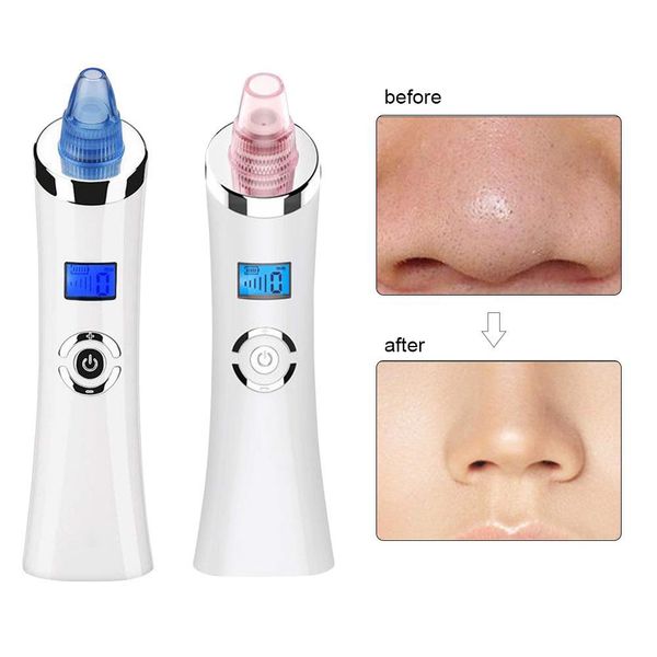 facial acne pores cleaner electric blackhead removerextractor usb charging 5 levels adjustment beauty instrument for women men
facial acne pores cleaner electric blackhead removerextractor usb charging 5 levels adjustment beauty instrument for women men