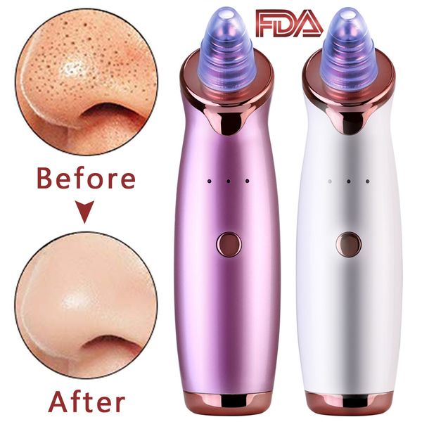 pro blackhead remover skin care pore vacuum acne pimple removal vacuum suction tool facial dermabrasion face black head clean 
pro blackhead remover skin care pore vacuum acne pimple removal vacuum suction tool facial dermabrasion face black head clean