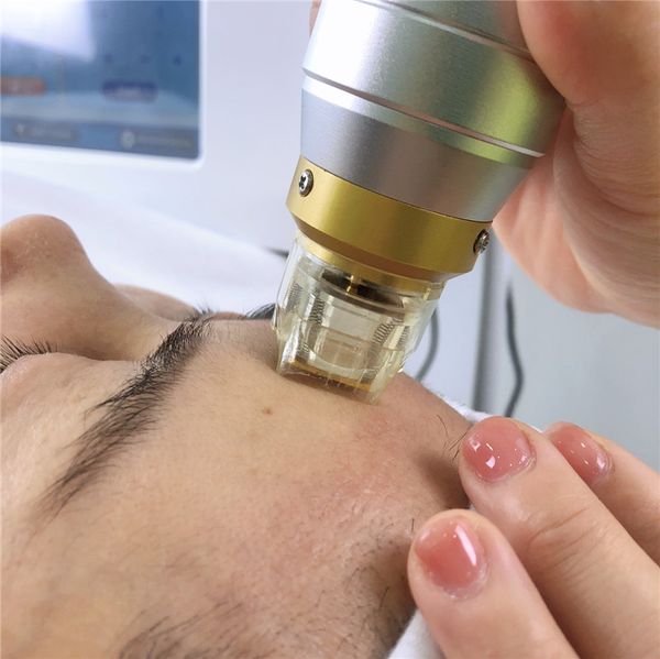 microneedling fractional rf therapy machine with therms cooling handle for stretch marks fractional rf machine
microneedling fractional rf therapy machine with therms cooling handle for stretch marks fractional rf machine