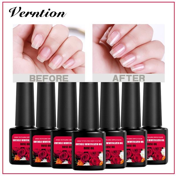 verntion cuticle oil nourishing oil set nail polish fruit flavor 8ml manicure cuticle gellak base coat uv nails design nails, Red;pink
verntion cuticle oil nourishing oil set nail polish fruit flavor 8ml manicure cuticle gellak base coat uv nails design nails, Red;pink