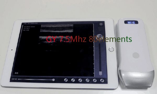 wifi linear probe with color doppler,wireless ultrasound,ultrasonic linear probe,echo device,probe usg machine
wifi linear probe with color doppler,wireless ultrasound,ultrasonic linear probe,echo device,probe usg machine