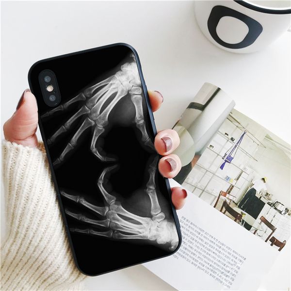 fundas x heart cover for iphone 11 pro xs max xr case for iphone 8 7 6s plus 5s se 5 case soft silicone cover.
fundas x heart cover for iphone 11 pro xs max xr case for iphone 8 7 6s plus 5s se 5 case soft silicone cover.