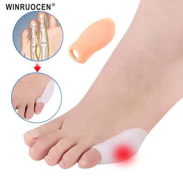 2pcs silicone small toe separator bunion splint small valgus orthosis correction overlapping spreader foot protector inserts, Black
2pcs silicone small toe separator bunion splint small valgus orthosis correction overlapping spreader foot protector inserts, Black