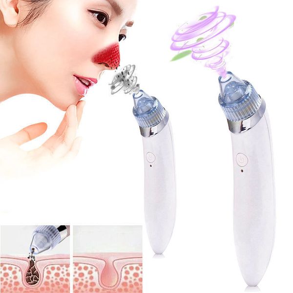 beauty remove blackhead removal equipment black head cleaner abs white fast fashion cosmetic instrument effective skin care
beauty remove blackhead removal equipment black head cleaner abs white fast fashion cosmetic instrument effective skin care