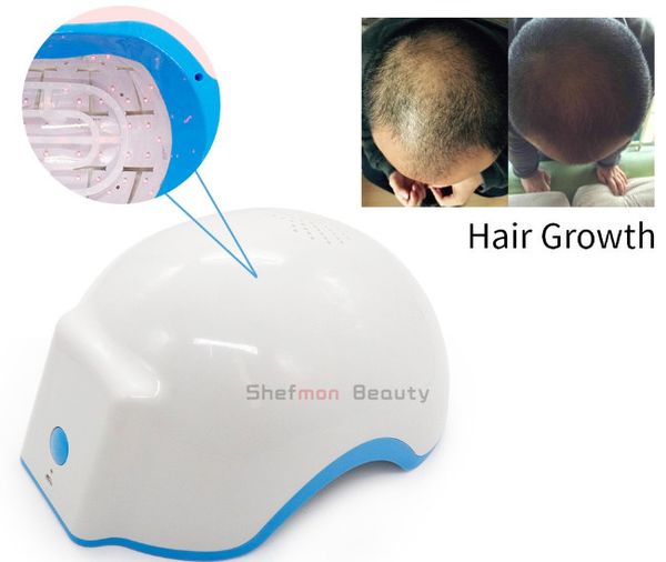 design hair regrowth laser therapy anti-hair removal machine for personal use repair damaged, Black
design hair regrowth laser therapy anti-hair removal machine for personal use repair damaged, Black