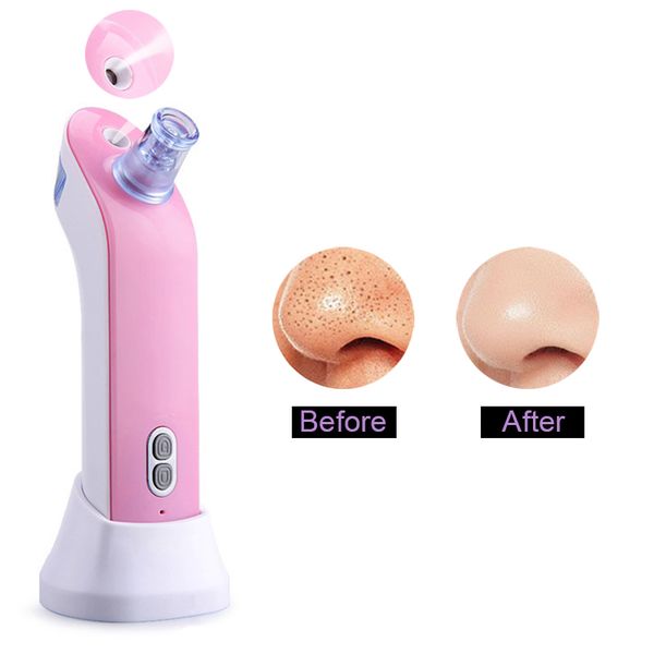 2in1 vacuum blackhead remover facial steamer instrument utilizes concealer spot cleaner pen carnation extractor beauty tool
2in1 vacuum blackhead remover facial steamer instrument utilizes concealer spot cleaner pen carnation extractor beauty tool
