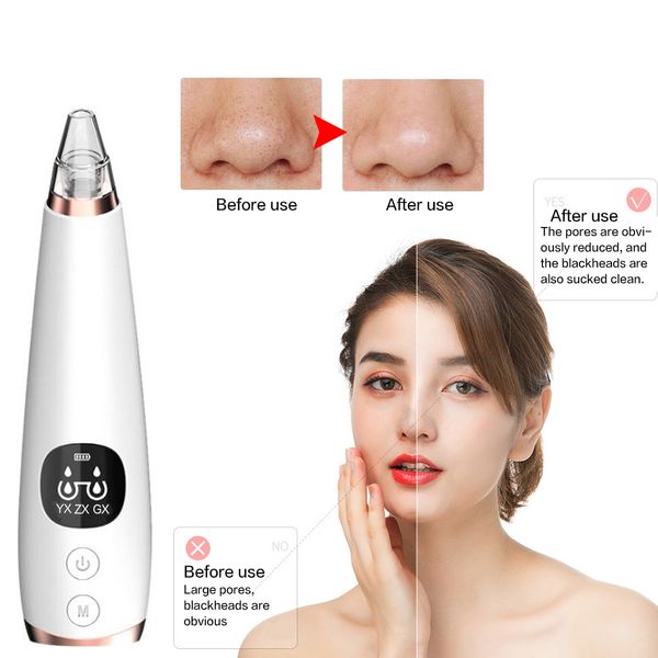 beurha blackhead remover face deep pore cleaner acne pimple removal vacuum suction facial spa diamond beauty care tool skin care
beurha blackhead remover face deep pore cleaner acne pimple removal vacuum suction facial spa diamond beauty care tool skin care