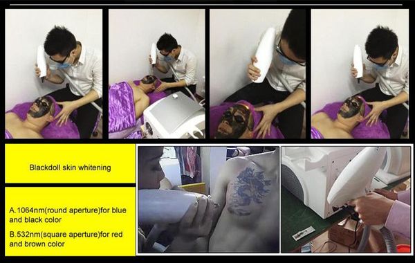 lf-653 professional nd yag laser portable laser tattoo removal machine, Black
lf-653 professional nd yag laser portable laser tattoo removal machine, Black