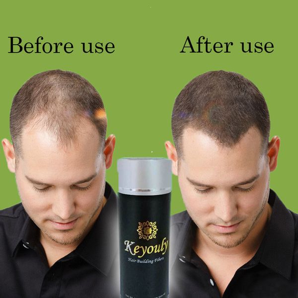 keyouly hair fiber 25g 4 colors anti hair loss product cover bald area hair building fiber resist wind rain
keyouly hair fiber 25g 4 colors anti hair loss product cover bald area hair building fiber resist wind rain