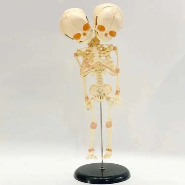 room Luxury Designer Decor 37Cm Human Double Head Baby Skull Skeleton Anatomy Brain Display Study Teaching Anatomical Model Halloween Bar Or 9