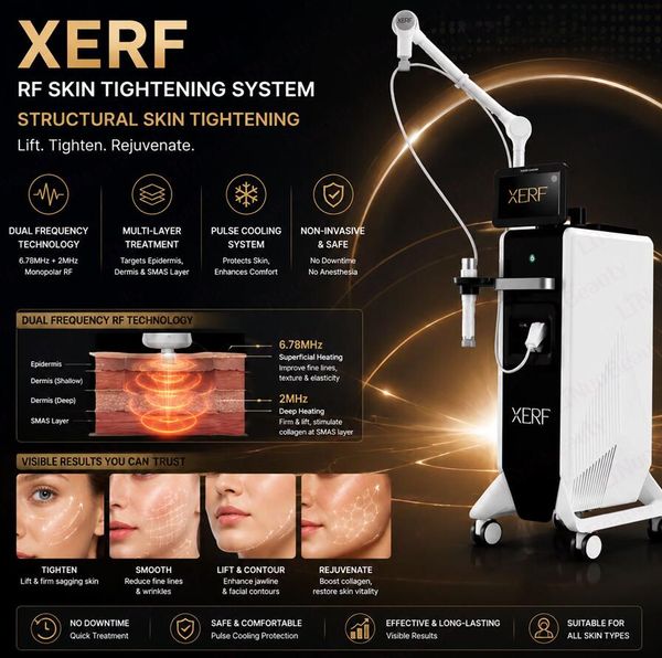 Factory price XERF Dual- RF Stimulates collagen production via layered heating, painlessly tighten Face Lift Machine Painless Skin Tightening Beauty machine