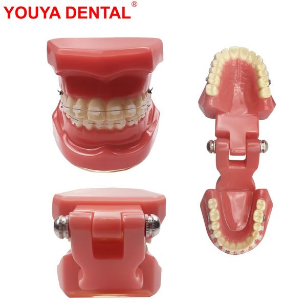 Dental Typodont Orthodontic Teeth Model With Braces Ceramic — compare prices at CompareOffers
