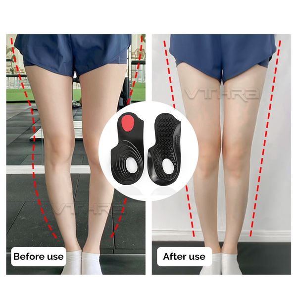 shoe parts accessories ox leg ort ics cubtus varus sol dalam kaki datar setengah ordi untuk sisipan sepatu bantalan penopang lengkung planta, White;pink
shoe parts accessories ox leg ort ics cubtus varus sol dalam kaki datar setengah ordi untuk sisipan sepatu bantalan penopang lengkung planta, White;pink