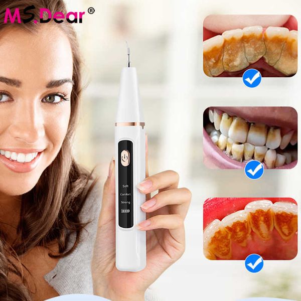 oral irrigators other hygiene ms.dear electric teeth tartar cleaner dental high-frequency vibration for plaque stains removal tooth brush 22
oral irrigators other hygiene ms.dear electric teeth tartar cleaner dental high-frequency vibration for plaque stains removal tooth brush 22