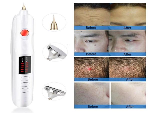 mini plasma pen eyelid lifting face lift needle spot removal face freckle wart wrinkle tattoo remover skin care home use bea9750491, Black
mini plasma pen eyelid lifting face lift needle spot removal face freckle wart wrinkle tattoo remover skin care home use bea9750491, Black