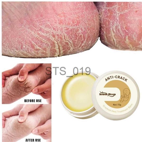foot treatment herbal anti cracked heel treatment cream anti-drying removal callus dead skin balm hand foot mositurizing repair skin care ma
foot treatment herbal anti cracked heel treatment cream anti-drying removal callus dead skin balm hand foot mositurizing repair skin care ma