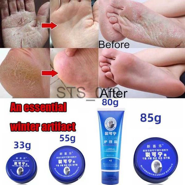 foot treatment winter essential artifact chinese medicine oil anti-chapped frostbite repair cream remove dead skin hand and foot home care x
foot treatment winter essential artifact chinese medicine oil anti-chapped frostbite repair cream remove dead skin hand and foot home care x