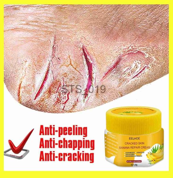 foot treatment banana anti crack foot cream heel cracked repair oil remove dead skin callu nourish anti-dry smooth winter hand feet beauty c
foot treatment banana anti crack foot cream heel cracked repair oil remove dead skin callu nourish anti-dry smooth winter hand feet beauty c