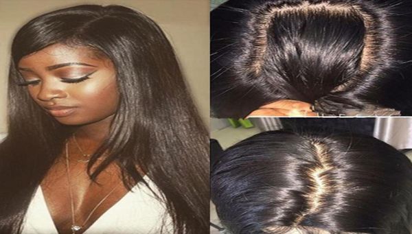 glueless silk full lace wigs with baby hair brazilian lace front human hair wigs for black women silk base lace wigs49352044573351, Black;brown
glueless silk full lace wigs with baby hair brazilian lace front human hair wigs for black women silk base lace wigs49352044573351, Black;brown