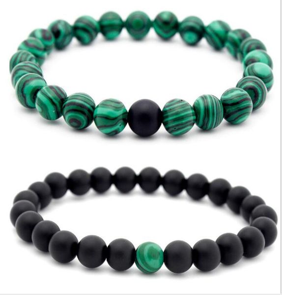 jln matte onyx malachite couple bracelet power beads stretched bracelets for man woman6779936, Black
jln matte onyx malachite couple bracelet power beads stretched bracelets for man woman6779936, Black