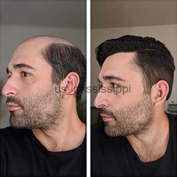 synthetic wigs mono base toupee men indian natural hair wig for men toupee men's wig male wigs for man hairpiece mens hair replacement, Black
synthetic wigs mono base toupee men indian natural hair wig for men toupee men's wig male wigs for man hairpiece mens hair replacement, Black