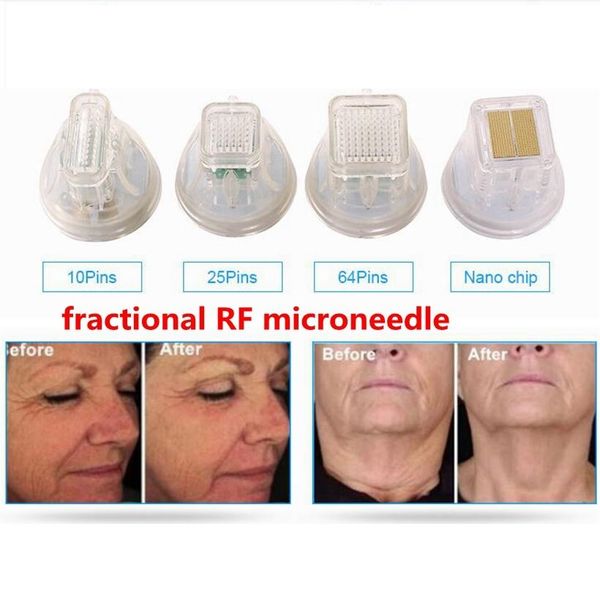 rf microneedling needle tip cartridge 10pin 25pin 64pin nano accessories & parts microneedle rf cartridge parts
rf microneedling needle tip cartridge 10pin 25pin 64pin nano accessories & parts microneedle rf cartridge parts