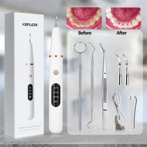 other oral hygiene g6 ultrasonic dental calculus remover teeth plaque tartar eliminator stains cleaner electric dental tooth stone remover 2
other oral hygiene g6 ultrasonic dental calculus remover teeth plaque tartar eliminator stains cleaner electric dental tooth stone remover 2