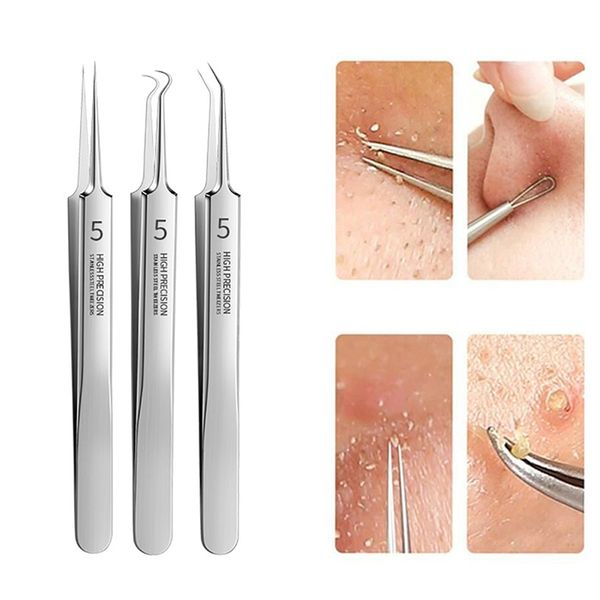 3/4/5pcs stainless steel acne blackhead removal kit acne blemish pimple extractor remover needles face skin care cleaning tools
3/4/5pcs stainless steel acne blackhead removal kit acne blemish pimple extractor remover needles face skin care cleaning tools