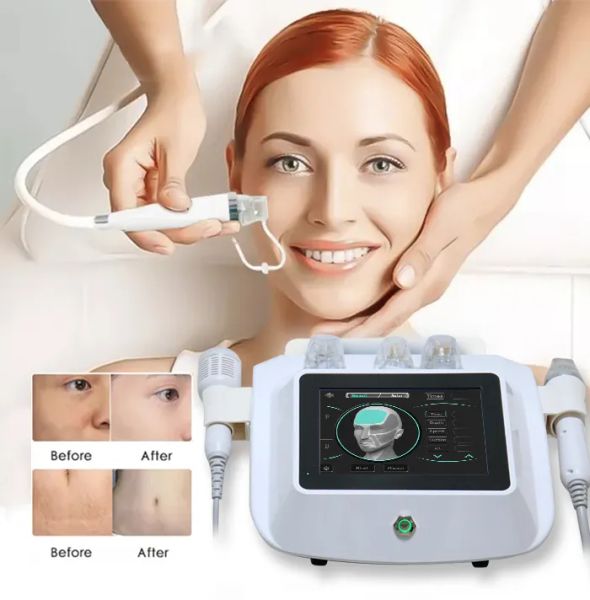 beauty items fractional rf microneedling machine microneedle skin care tightening anti wrinkle scar radio frequency therapy rf equipment
beauty items fractional rf microneedling machine microneedle skin care tightening anti wrinkle scar radio frequency therapy rf equipment