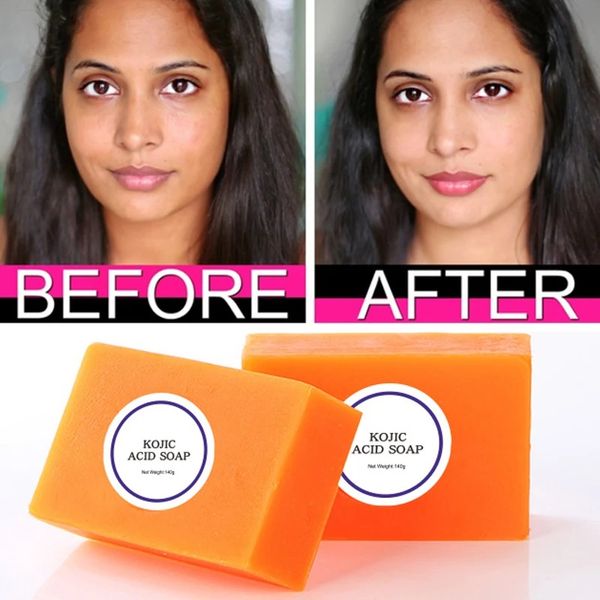140g soap 3 colors option glutathione soap skin lightening soap hand made soap skin bleaching soap brightening face
140g soap 3 colors option glutathione soap skin lightening soap hand made soap skin bleaching soap brightening face