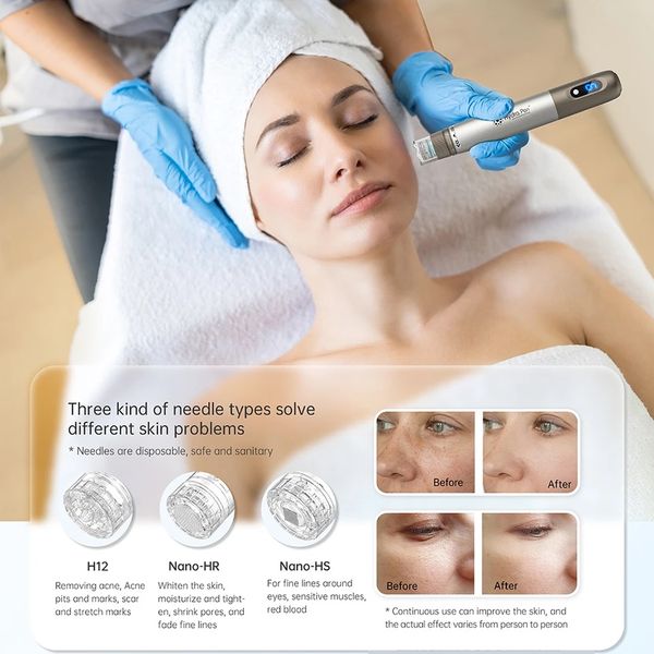 h3 hydra pen mesotherapy gun auto serum applicator anti acne shrink pores red blood fine line round eye skin tighten moisturize, Black;white
h3 hydra pen mesotherapy gun auto serum applicator anti acne shrink pores red blood fine line round eye skin tighten moisturize, Black;white